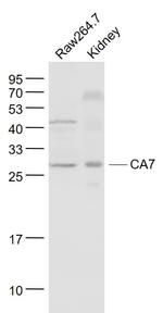 CA7 Antibody in Western Blot (WB)