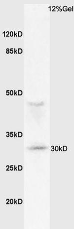 MHC Class 2 Antibody in Western Blot (WB)