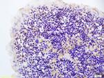 Hairless Antibody in Immunohistochemistry (Paraffin) (IHC (P))