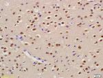 USP22 Antibody in Immunohistochemistry (Paraffin) (IHC (P))