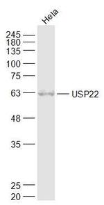 USP22 Antibody in Western Blot (WB)