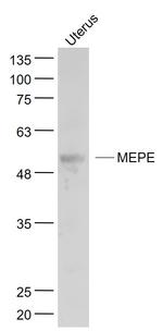 MEPE Antibody in Western Blot (WB)