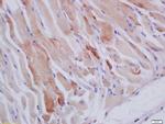 HSPB7 Antibody in Immunohistochemistry (Paraffin) (IHC (P))