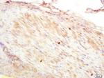 CNN2 Antibody in Immunohistochemistry (Paraffin) (IHC (P))