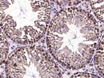 SHARPIN Antibody in Immunohistochemistry (Paraffin) (IHC (P))