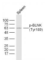 Phospho-BLNK (Tyr189) Antibody in Western Blot (WB)