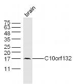 C10orf132 Antibody in Western Blot (WB)