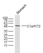 C1orf172 Antibody in Western Blot (WB)