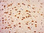 WIPF2 Antibody in Immunohistochemistry (Paraffin) (IHC (P))