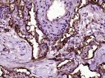 ICAM1/CD54 Antibody in Immunohistochemistry (Paraffin) (IHC (P))