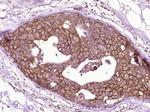 C-erbB-2/HER2 Antibody in Immunohistochemistry (Paraffin) (IHC (P))