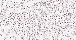 Histone H3 (tri methyl K79) Antibody in Immunohistochemistry (Paraffin) (IHC (P))