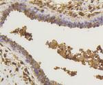 NF-kB p65 Antibody in Immunohistochemistry (Paraffin) (IHC (P))