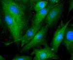 Tubulin beta-III Antibody in Immunocytochemistry (ICC/IF)