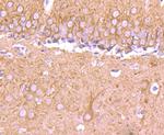 Tubulin beta-III Antibody in Immunohistochemistry (Paraffin) (IHC (P))