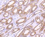 MMP14 Antibody in Immunohistochemistry (Paraffin) (IHC (P))