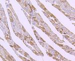 SOD2 Antibody in Immunohistochemistry (Paraffin) (IHC (P))