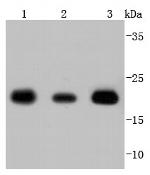 SOD2 Antibody in Western Blot (WB)