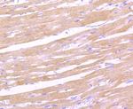 CD163 Antibody in Immunohistochemistry (Paraffin) (IHC (P))