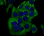 Cytochrome P450 17A1 Antibody in Immunocytochemistry (ICC/IF)