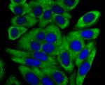 Cytochrome P450 17A1 Antibody in Immunocytochemistry (ICC/IF)