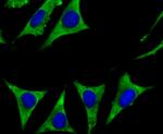 Cytochrome P450 17A1 Antibody in Immunocytochemistry (ICC/IF)