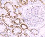 Cytochrome P450 17A1 Antibody in Immunohistochemistry (Paraffin) (IHC (P))