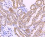 Cytochrome P450 17A1 Antibody in Immunohistochemistry (Paraffin) (IHC (P))