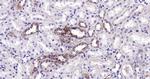 Cytochrome P450 17A1 Antibody in Immunohistochemistry (Paraffin) (IHC (P))