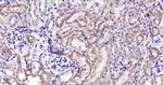 Cytochrome P450 17A1 Antibody in Immunohistochemistry (Paraffin) (IHC (P))