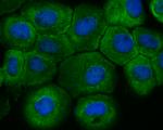 Fbx32 Antibody in Immunocytochemistry (ICC/IF)