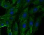 Fbx32 Antibody in Immunocytochemistry (ICC/IF)