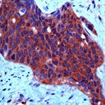 c-Met Antibody in Immunohistochemistry (IHC)