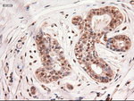 c-Myc Antibody in Immunohistochemistry (Paraffin) (IHC (P))