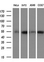 c-Myc Antibody in Western Blot (WB)