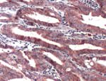 Tensin 4 Antibody in Immunohistochemistry (IHC)