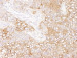 eEF2 Antibody in Immunohistochemistry (IHC)