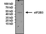 eIF2b gamma Antibody in Immunoprecipitation (IP)