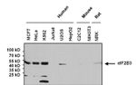 eIF2b gamma Antibody in Western Blot (WB)