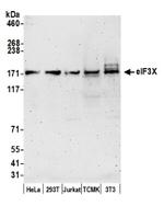eIF3X Antibody in Western Blot (WB)