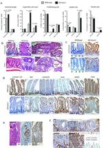 p19ARF Antibody in Immunohistochemistry (Paraffin) (IHC (P))