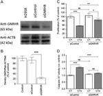 GnRHR Antibody in Western Blot (WB)