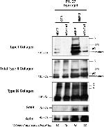 Collagen II Antibody in Western Blot (WB)