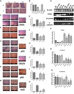 Cytokeratin 5/6 Antibody in Immunohistochemistry (IHC)