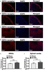 SSTR4 Antibody in Immunohistochemistry (IHC)