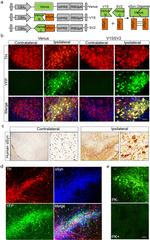 alpha Synuclein Antibody in Immunohistochemistry (IHC)