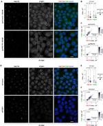 PTBP1 Antibody in Immunocytochemistry (ICC/IF)