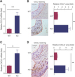 MCP-1 Antibody in Immunohistochemistry (IHC)