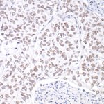 hSET1 Antibody in Immunohistochemistry (IHC)