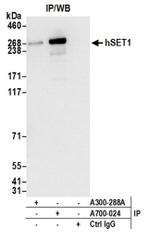 hSET1 Antibody in Western Blot (WB)